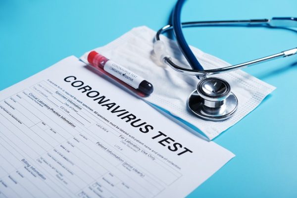 Test coronavirus a los empleados
